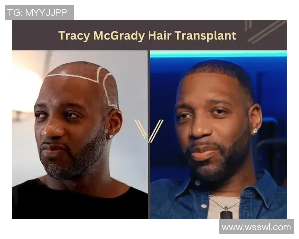 足球球星秃头现象：从外貌变化到心理挑战的全方位分析